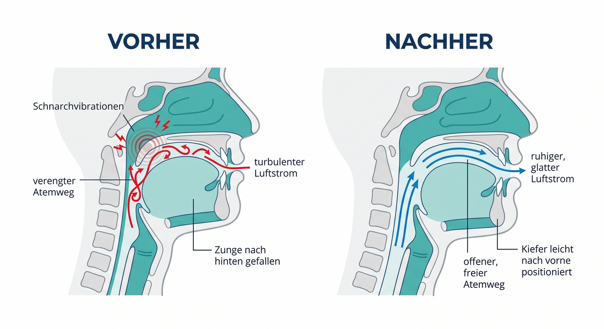 Vorher Nachher Vergleich